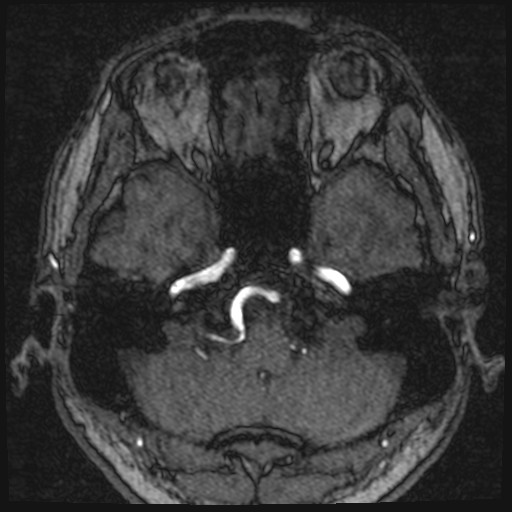 Click on the Serie image to view the images of VILLANUEVA, WILLIAM A.